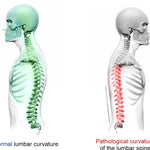 Estirador Lumbar Ajustable