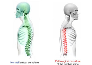 Estirador Lumbar Ajustable